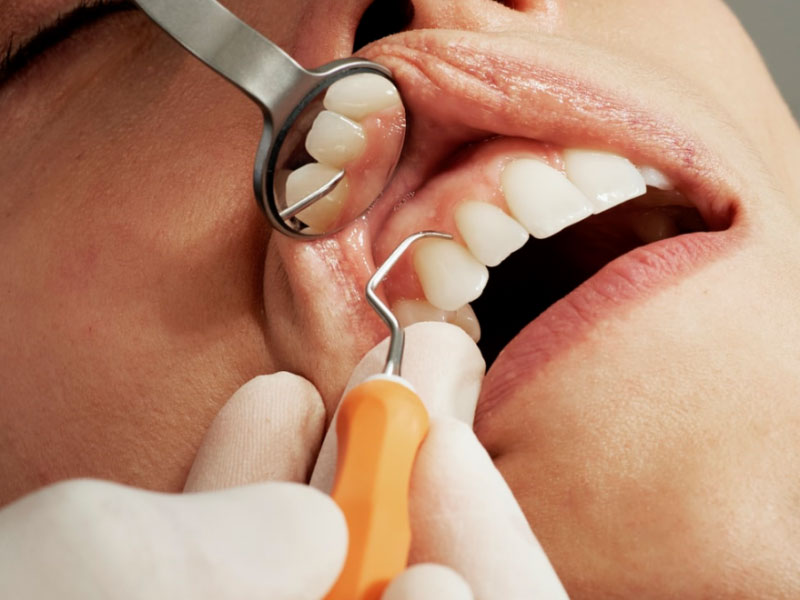 A patient getting a checkup as part of their healthy teeth & gums membership.