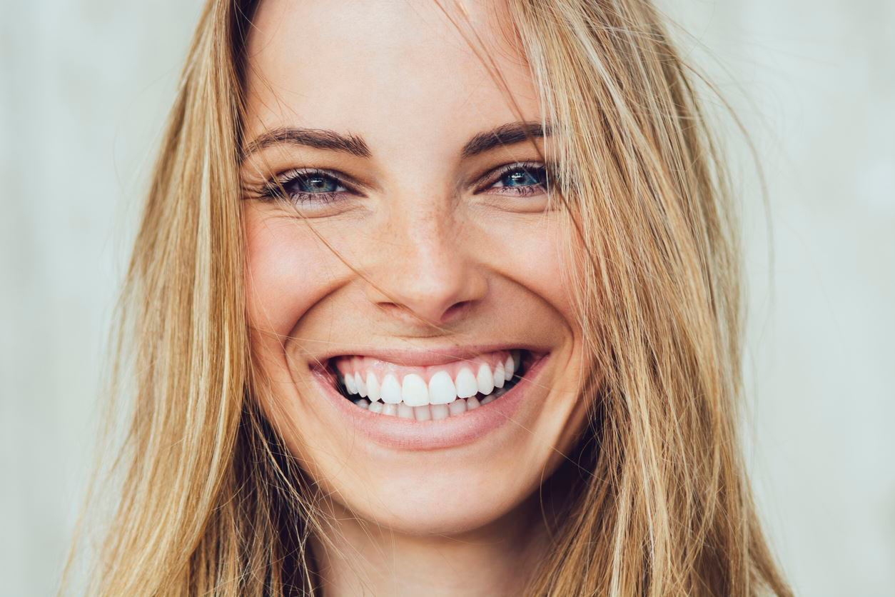 Woman smiling after a smile makeover